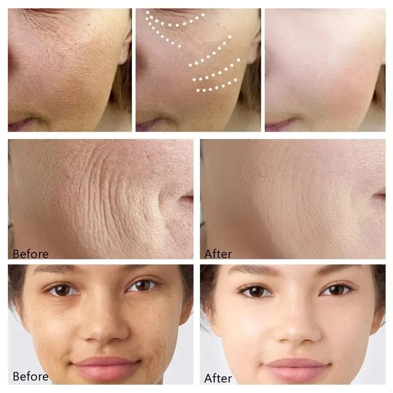 Retinol Face Cream Anti-rugas / aumenta a produção de colágeno da pèle