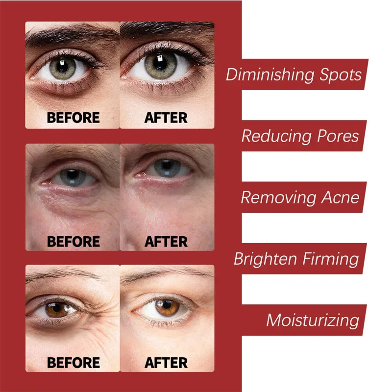 Retinol Face Cream Anti-rugas / aumenta a produção de colágeno da pèle