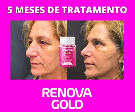 3x Renova Gold Serum + 3x Renova Gold 30 Cápsulas - Envio Rápido