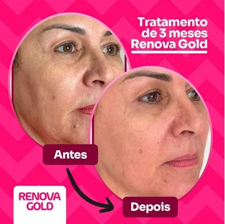 3x Renova Gold Serum + 3x Renova Gold 30 Cápsulas - Envio Rápido